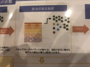 広島県廿日市市にあるプロッソル廿日市で抜け毛、髪のやせ細りに効果的なシャンプートリートメントのご紹介